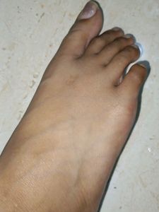 Instant Tan&amp;Dead Skin Removal