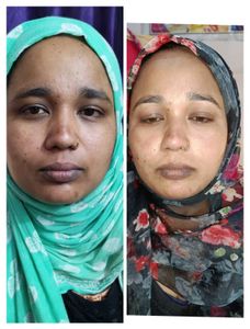 Night Cream With Soap Brightening 100%effective