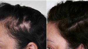 Rapid Regrow Hair Oil 100ml