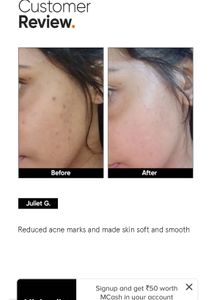Minimalist Niacinamide Serum