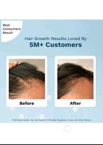 Hair Growth Serum 💞😍💞👌