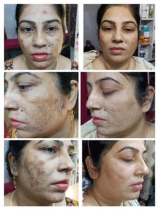 Night Cream With Soap Brightening 100%effective