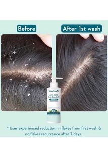 WishCare AHA BHA Anti-Dandruff Shampoo