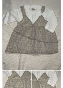 Baby Dresses Combo