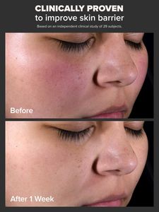 Paula&#39;s Choice 2% BHA Liquid Exfoliant