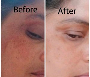 whitening night cream for all skin types