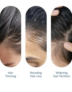 Bodywise Hair Growth Serum