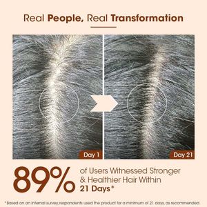 Pack Of 3 Bhringraj Anti Hairfall Oil