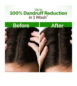 Mamaearth Lemon Anti - Dandruff Shampoo