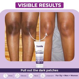 (Pack of 2) Sanfe Instant Masks