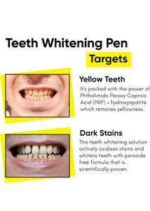 Teeth 🪥🦷 Whitening Pen 🖊️