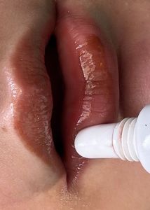 Rhode Peptide Combo
