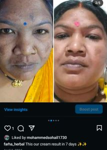 Skin Problem Solution