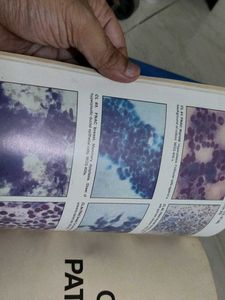 Textbook of Pathology
