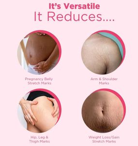 Orgatre Anti Stretch Marks Serum