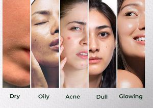 Ftune Skin Whitening Cream