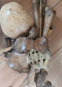 original bone set