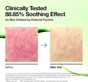 Anua Azelaic Acid Soothing Toner Pads (kbeauty)
