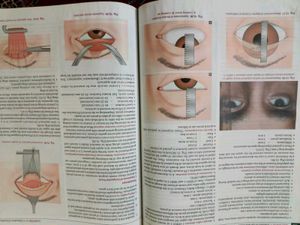 AK KHURANA -ophthalmology 8th edition