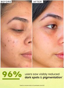 HYPHEN Radiance-Lift Serum