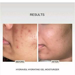 Hydra Veil Barrier Repair Ceramide Gel Moisturizer