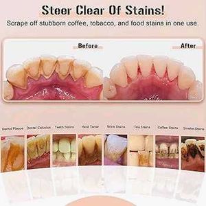 Electric Teeth Cleaner