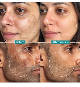 Pilgrim 15% Vitamin C Face Serum