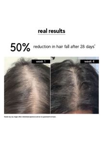 Inde Wild Champi Hair Oil