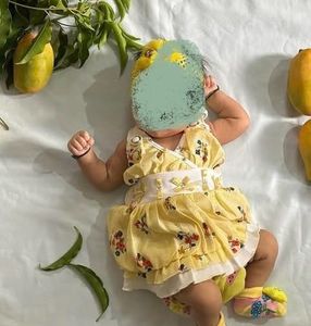 Yellow Color Baby Girl Frok
