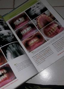 Fourth Editiion Orthodontics Textbook