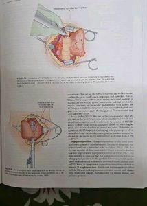 Sabiston Textbook of Surgery