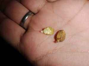 Karela Seeds/Bitter Guard/Blood Purifier 100%germinated With Prove...