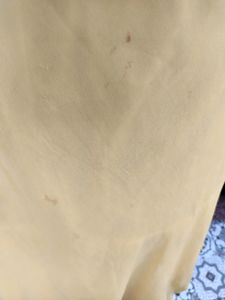 Yellow Mid Length Dress