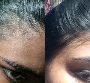 Homemade Secret Herbal Hair growth Oil