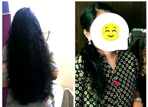 🔥today Only Coins🔥Hair Growth Seru