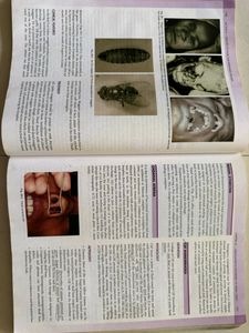 ENT Dhingra 8th edition