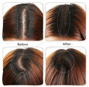 Hair Loss Concealer
