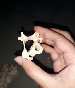Bone Set-3 (Vertebras + Sacrum) For Medicals!!✏