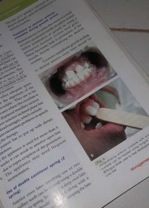 Fourth Editiion Orthodontics Textbook