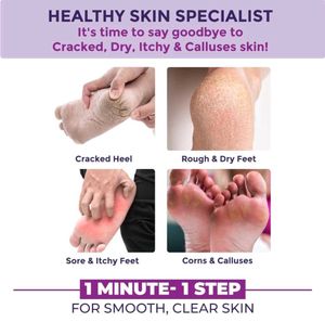 Sanfe Clear &amp; Confident Dry and Cracked Feet Cream