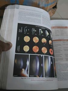 Comprehensive Ophthalmology 7th Edition