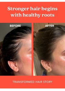 Organic Hair Growth Serum