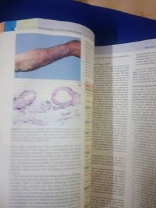 Medical MBBS PATHOLOGY ROBBINS AndCOTRAN -VOLUME1