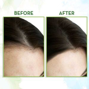 Mamaearth Rosemary Hair Growth Oil