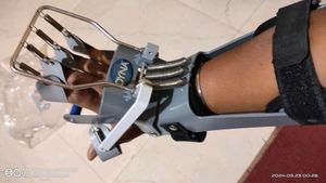 Dynamic Cock Up Splint (Finger Extension Assist)