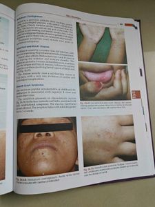 Ghai Essential Pediatrics 9th Edition