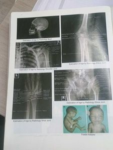 Second Year MBBS Sia Previous Years Question Paper