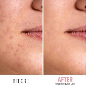 RENEE SNAIL 99 MUCIN SERUM