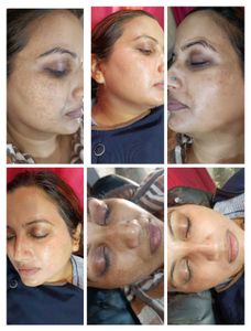 Night Cream With Soap Brightening 100%effective