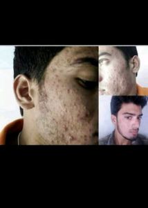 Hair And Skin All Problem Solution